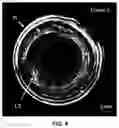 Fig. 11 - Systems and methods for performing frequency-domain photoacoustic imaging