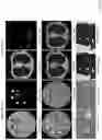 Fig. 27 - System and method for low-dose multi-spectral X-ray tomography