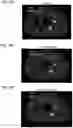 Fig. 09 - Apparatus and method for medical image reconstruction using deep learning to improve image quality in positron emission tomography (PET)