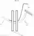 Fig. 16 - SUTURING APPARATUS USING AUTO-LOADING AND METHOD THEREOF