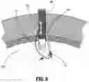 Fig. 08 - SUTURE PASSER INCLUDING AN ELECTROMAGNET