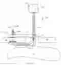 Fig. 18 - Hip capsule closure