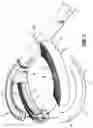 Fig. 03 - SURGICAL STAPLING DEVICE WITH SLEEVE TO IMPROVE GRASPING CAPABILITY