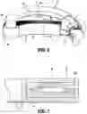 Fig. 06 - SURGICAL STAPLING DEVICE WITH SLEEVE TO IMPROVE GRASPING CAPABILITY