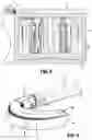Fig. 07 - SURGICAL STAPLING DEVICE WITH SLEEVE TO IMPROVE GRASPING CAPABILITY