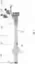 Fig. 07 - FLOW RESTRICTING INTRAVASCULAR DEVICES FOR TREATING EDEMA