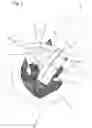 Fig. 02 - Cutting guide for spinal osteotomy