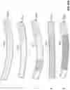 Fig. 49 - Clot removal methods and devices with multiple independently controllable elements