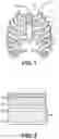 Fig. 02 - BONE-PENETRATING INTRAOSSEOUS ACCESS DEVICE