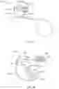 Fig. 24 - Systems and methods for surgical procedures using band clamp implants and tensioning instruments