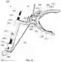 Fig. 06 - Tensioning instruments