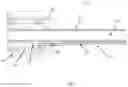 Fig. 09 - RF energy enabled tissue debridement device