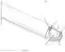 Fig. 43 - RF energy enabled tissue debridement device