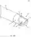 Fig. 45 - RF energy enabled tissue debridement device