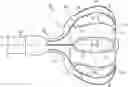 Fig. 01 - Printed proximal electrodes of an expandable catheter for use as a common electrode