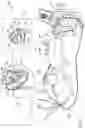 Fig. 02 - Printed proximal electrodes of an expandable catheter for use as a common electrode