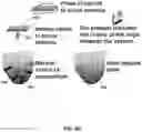 Fig. 07 - SYSTEM AND METHOD FOR IMPLANTING LEFT VENTRICULAR ASSIST DEVICES