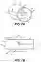 Fig. 07 - Devices and methods for protecting against neuromas