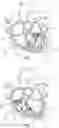 Fig. 02 - Transcatheter anchor support and methods of implantation