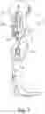 Fig. 02 - Orthotic or prosthetic joint device, and method for controlling same