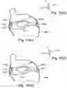 Fig. 15 - Bottle assembly and valve assembly