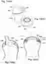 Fig. 16 - Bottle assembly and valve assembly