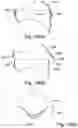 Fig. 22 - Bottle assembly and valve assembly