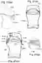 Fig. 24 - Bottle assembly and valve assembly