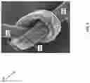 Fig. 11 - CHEMICAL MEMBRANE COMPLEX REPAIR SOLUTION AND METHOD OF USING THE SAME