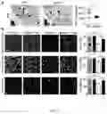 Fig. 06 - METHOD OF TREATING OR PREVENTING NEURODEGENERATION