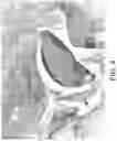 Fig. 07 - Methods of treating viral infections affecting the respiratory tract using topically administered lithium agents
