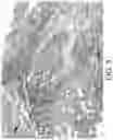 Fig. 08 - Methods of treating viral infections affecting the respiratory tract using topically administered lithium agents