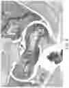 Fig. 09 - Methods of treating viral infections affecting the respiratory tract using topically administered lithium agents