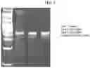 Fig. 04 - TUMOR INFILTRATING LYMPHOCYTES AND METHODS OF THERAPY