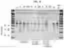 Fig. 10 - TUMOR INFILTRATING LYMPHOCYTES AND METHODS OF THERAPY