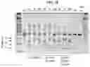 Fig. 11 - TUMOR INFILTRATING LYMPHOCYTES AND METHODS OF THERAPY