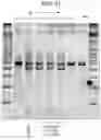 Fig. 12 - TUMOR INFILTRATING LYMPHOCYTES AND METHODS OF THERAPY