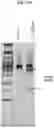 Fig. 31 - TUMOR INFILTRATING LYMPHOCYTES AND METHODS OF THERAPY