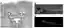 Fig. 01 - COMPOSITION AND METHODS OF AN ADVANCED THERAPY FOR NEURODEGENERATIVE DISEASES