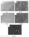 Fig. 03 - BONE AUGMENTATION UTILIZING MUSCLE-DERIVED PROGENITOR COMPOSITIONS, AND TREATMENTS THEREOF