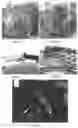 Fig. 07 - BONE AUGMENTATION UTILIZING MUSCLE-DERIVED PROGENITOR COMPOSITIONS, AND TREATMENTS THEREOF