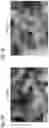 Fig. 07 - Agent for inducing interferon production containing lactic acid bacteria
