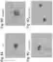Fig. 16 - Agent for inducing interferon production containing lactic acid bacteria