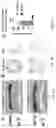 Fig. 07 - ASARM TREATMENT FOR KIDNEY AND MINERALIZATION DISORDERS AND HYPERPHOSPHATEMIA