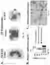 Fig. 08 - ASARM TREATMENT FOR KIDNEY AND MINERALIZATION DISORDERS AND HYPERPHOSPHATEMIA