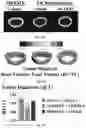 Fig. 09 - ASARM TREATMENT FOR KIDNEY AND MINERALIZATION DISORDERS AND HYPERPHOSPHATEMIA
