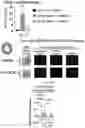 Fig. 11 - ASARM TREATMENT FOR KIDNEY AND MINERALIZATION DISORDERS AND HYPERPHOSPHATEMIA