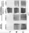 Fig. 15 - ASARM TREATMENT FOR KIDNEY AND MINERALIZATION DISORDERS AND HYPERPHOSPHATEMIA
