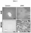 Fig. 02 - Composition for and Method of Treating Hepatic Tissue Injury