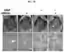Fig. 07 - Composition for and Method of Treating Hepatic Tissue Injury